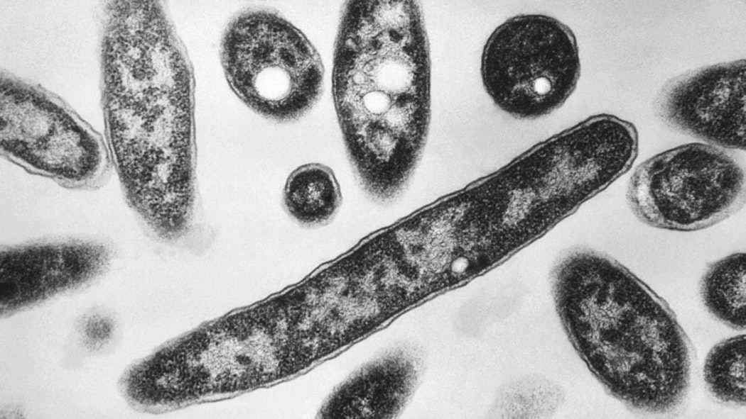 Legionella pneumophila bacteria; Legionnaires' disease