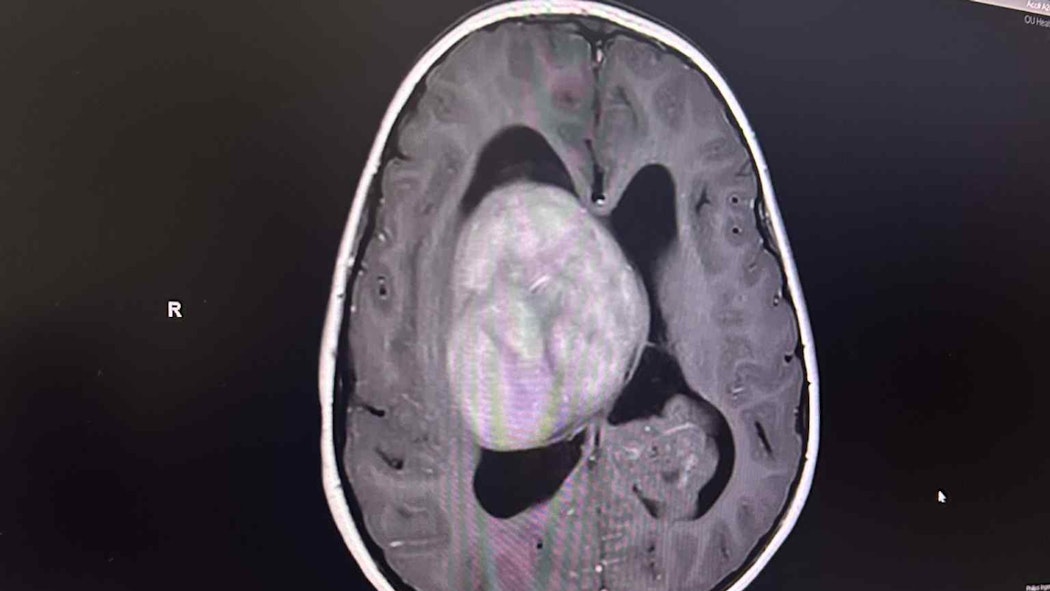 Julian Brain Scan